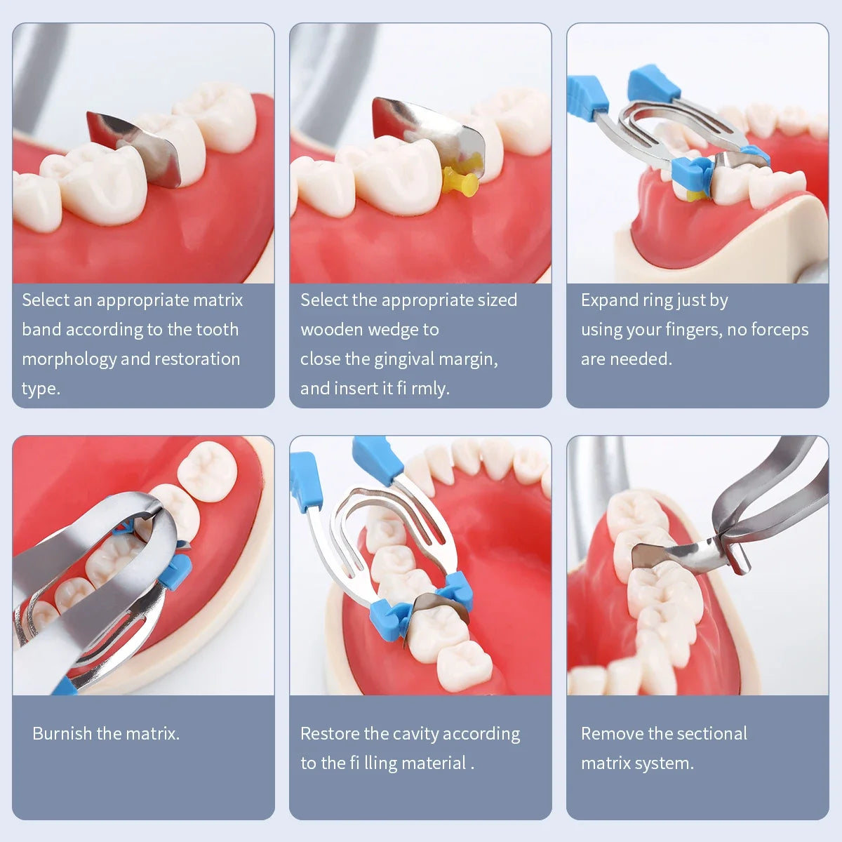 Dental Matrix Sectional Contoured Matrices Clamps Wedges Metal Spring Clip Rings Dentist Tools Dental Lab Instrument