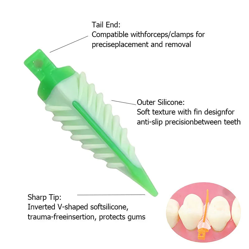 Silicone Dental Interdental Wedges Sealing Composite Adaptive Wedge Material For Tooth Restoration And Filling
