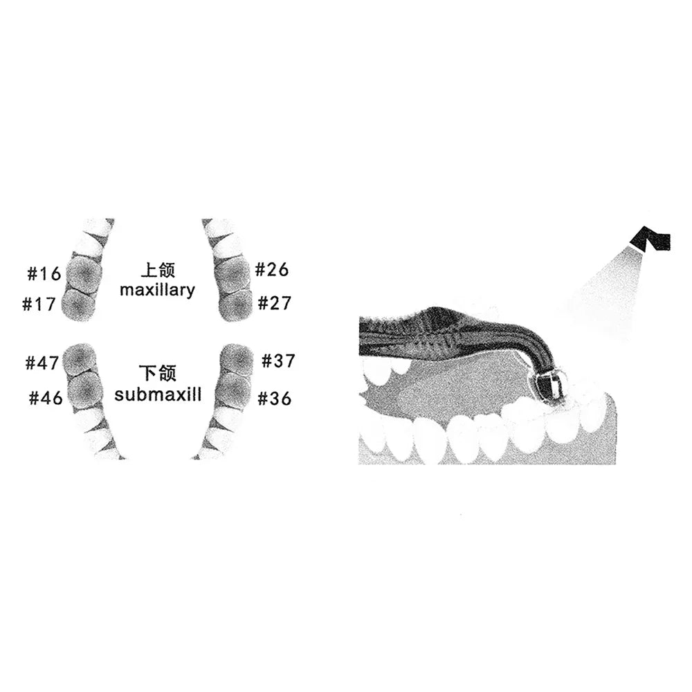 Dental Posterior Teeth Aesthetic Printing Mould Kit For Light Cure Composite Restoration Filling Tools