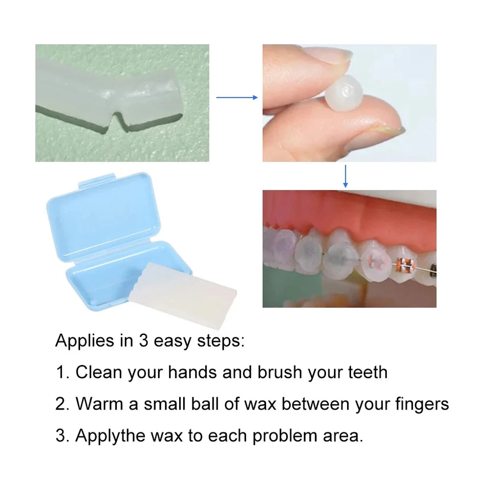 10Packs Dental Orthodontic Relief Wax for Bracket Patient Relief Protect Lips and Gums Irritation Fruit 10 Scents