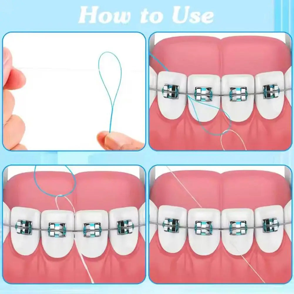 Dental Floss Threaders Needle Tooth Brackets Wire Holders Between Orthodontic Bridges Traction Braces Dentist Oral Cleaning Tool
