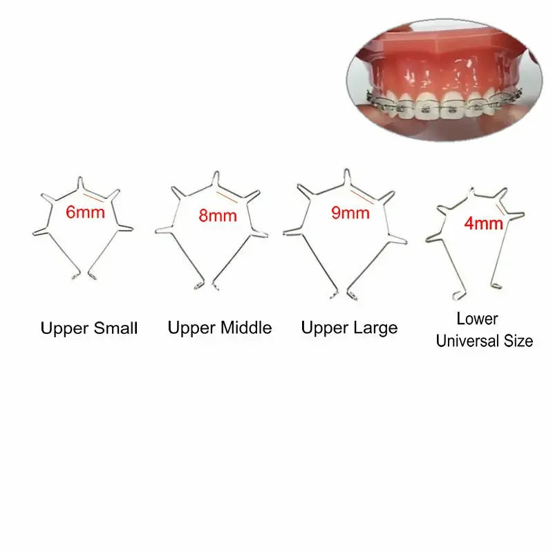 1 Bag Dental Anterior Root Torquing Auxiliary Arch Teeth Torque Spring Orthodontic Materials